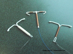 Things every woman must know about Copper-T