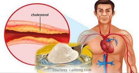 High Cholesterol: Causes, Effects and Treatment